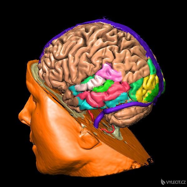 3D pohled na mozek, autor: Muehlenau
