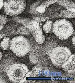 Virus žloutenky typu B pod mikroskopem. Autor: GrahamColm