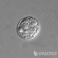 prvok Toxoplasma gondii je mikroskopického vzhledu, čili není viditelný pouhým okem, autor: Patho