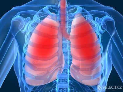 Zápal plic může mít hned několik příčin, autor: schizmacus