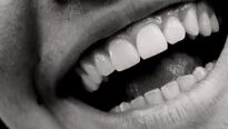Nebojte se usmát aneb jak mít krásné zuby?