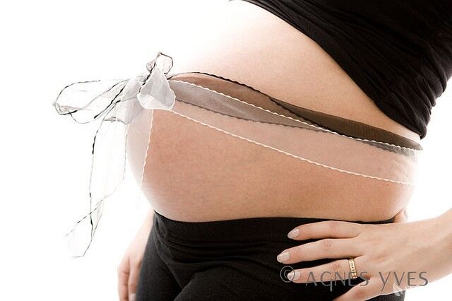 Nastávající maminky by měly podstoupit 4D ultrazvuk, autor: Agnes Yves