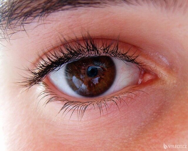 Oční klinika vám poskytne tu nejlepší péči, autor: orangeacid